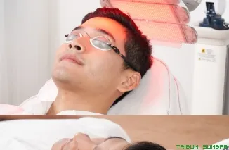 Kebotakan Dini di Usia 20--30 Tahun Makin Banyak Terjadi, Ini penjelasan Dokter ERHA.