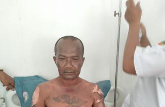 Franki sang hero, aksonya selamatkan kebakaran besar di Solok, tengah mendapatkan perawatan medis di RST Kota Solok. (dok) 